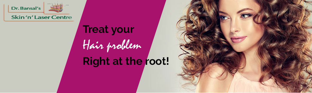 Hair Loss Treatment